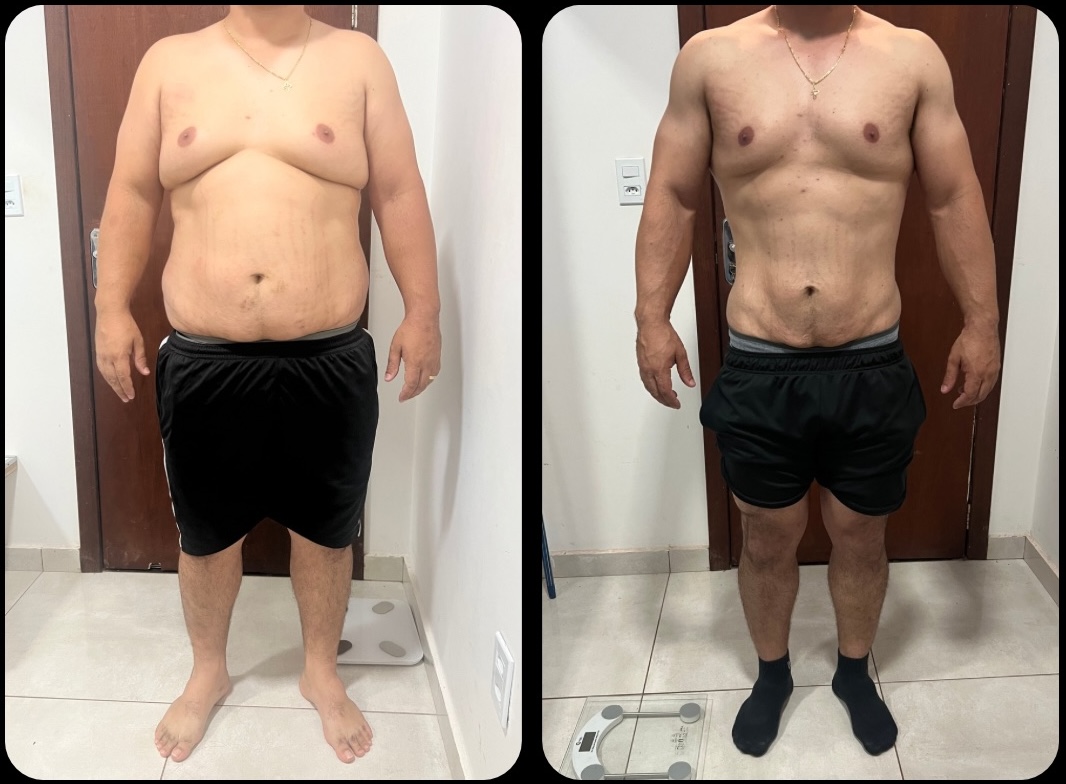 Transformação 7